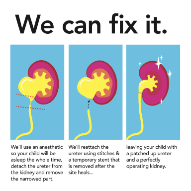 We can fix it design example.